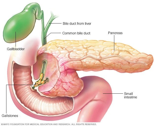 Páncreas inflamado: síntomas a tener en cuenta