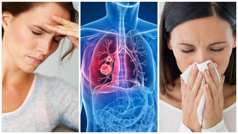 ¿Cómo se manifiesta el cáncer de pulmón?