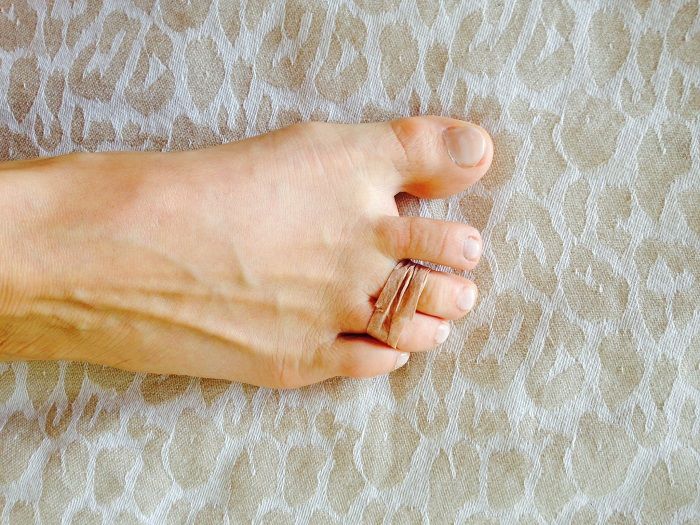 Cómo evitar el dolor en los pies en tacones altos