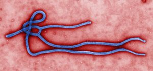 ¿Qué es el virus del ébola?
